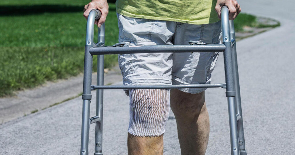 Post-Surgery Tips for a Successful Knee Replacement Surgery Recovery